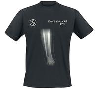 Foo Fighters T Shirt X Ray Broken Leg 2016 Band Logo Nue offiziell Herren L